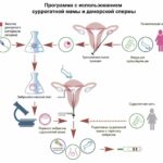 Беременность суррогатной матери: процесс и этапы